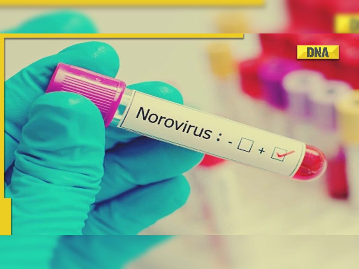 Norovirus cases in Kerala: Know all about virus, symptoms, causes and how dangerous is it?