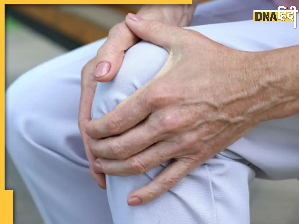 Joint Pain: यूरिक एसिड के कम होते ही खत्म हो जाएगा जोड़ों का दर्द, जानें कैसे करें कंट्रोल 