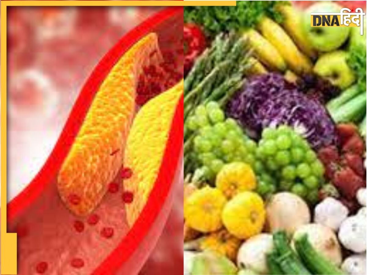 High Cholesterol को कंट्रोल करने के लिए Diet में शामिल करें ये पांच फल, बैड कोलेस्ट्रॉल कर देते हैं बाहर