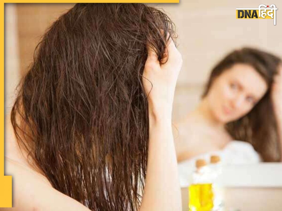 Worst Hair oil: बालों में कहीं ये तेल तो नहीं लगाते आप? बंद कर दें इनसे हेयर मसाज वरना हो जाएंगे गंजे