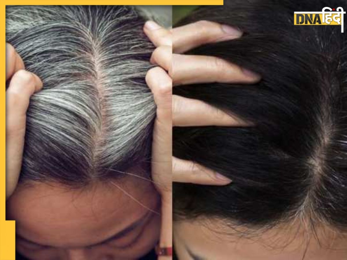 White Hair Remedy: सफेद होते बालों पर ब्रेक लगा देंगी ये 3 चीजें, बिना खर्च Black होंगे Hair