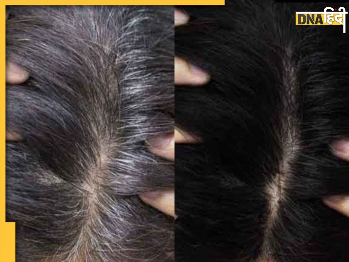 White Hair Remedy: इन नेचुरल चीजों से सफेद बाल होंगे Black, 50 साल की उम्र में भी नहीं पड़ेगी डाई की जरूरत