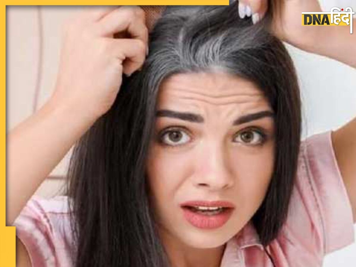 White Hair Remedy: घर में मिलने वाली इन 2 चीजों के इस्तेमाल से नहीं होंगे बाल सफेद, दक्षिण भारतीय अपनाते हैं य�े नेचुरल तरीका