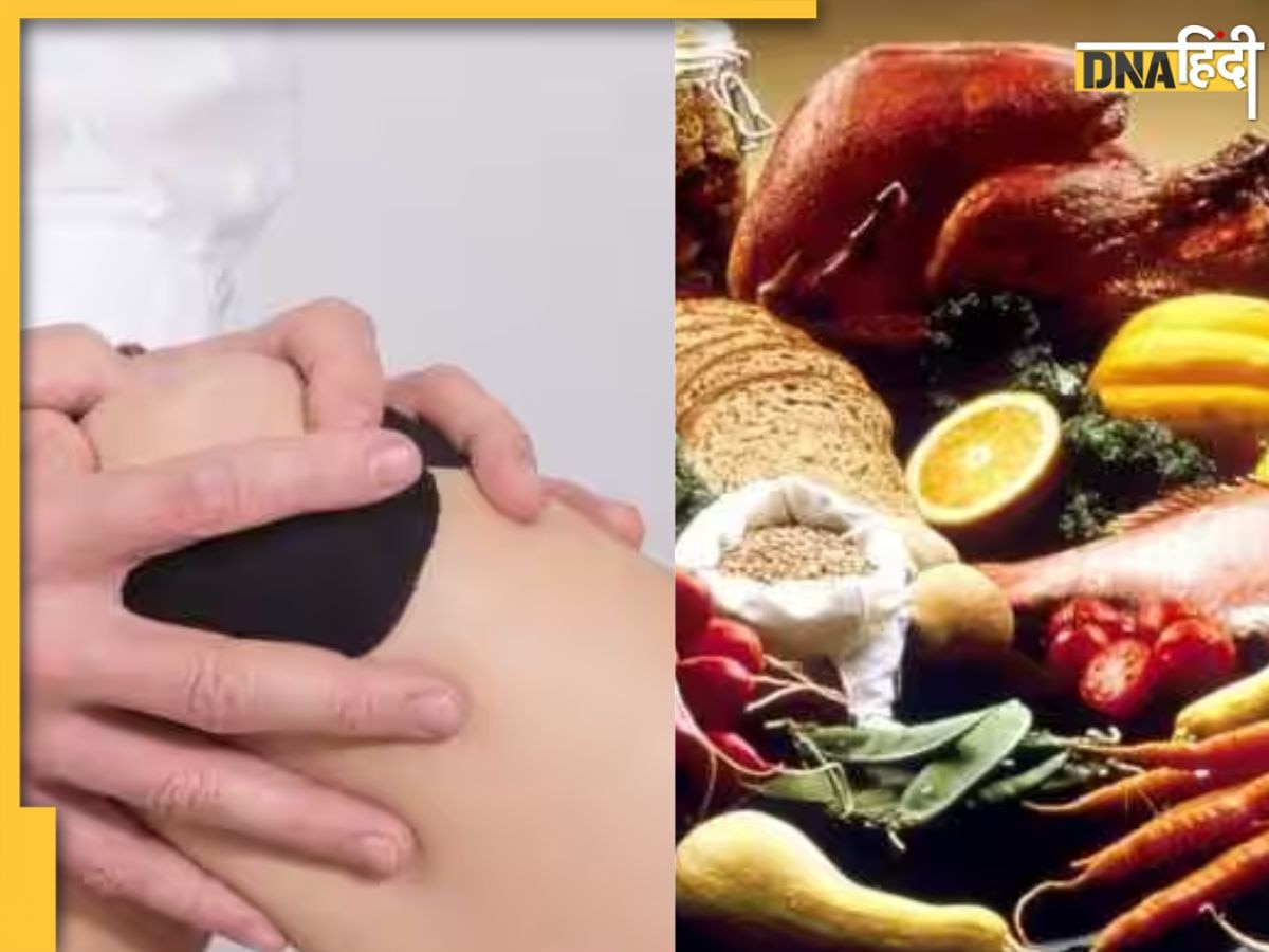 Uric Acid Home Remedies: बिना किसी दवा और इलाज के घर बैठे अपनाएं ये 4 उपाय, हाई यूरिक एसिड भी हो जाएगा कंट्रोल