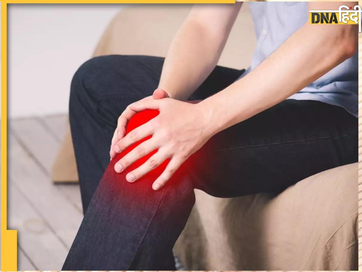 Arthritis Remedy: जोड़ों की जकड़न-दर्द में अमृत हैं ये हर्ब्स, यूरिक एसिड कम करने में बेमिसाल हैं 5 जड़ी बूटियां 