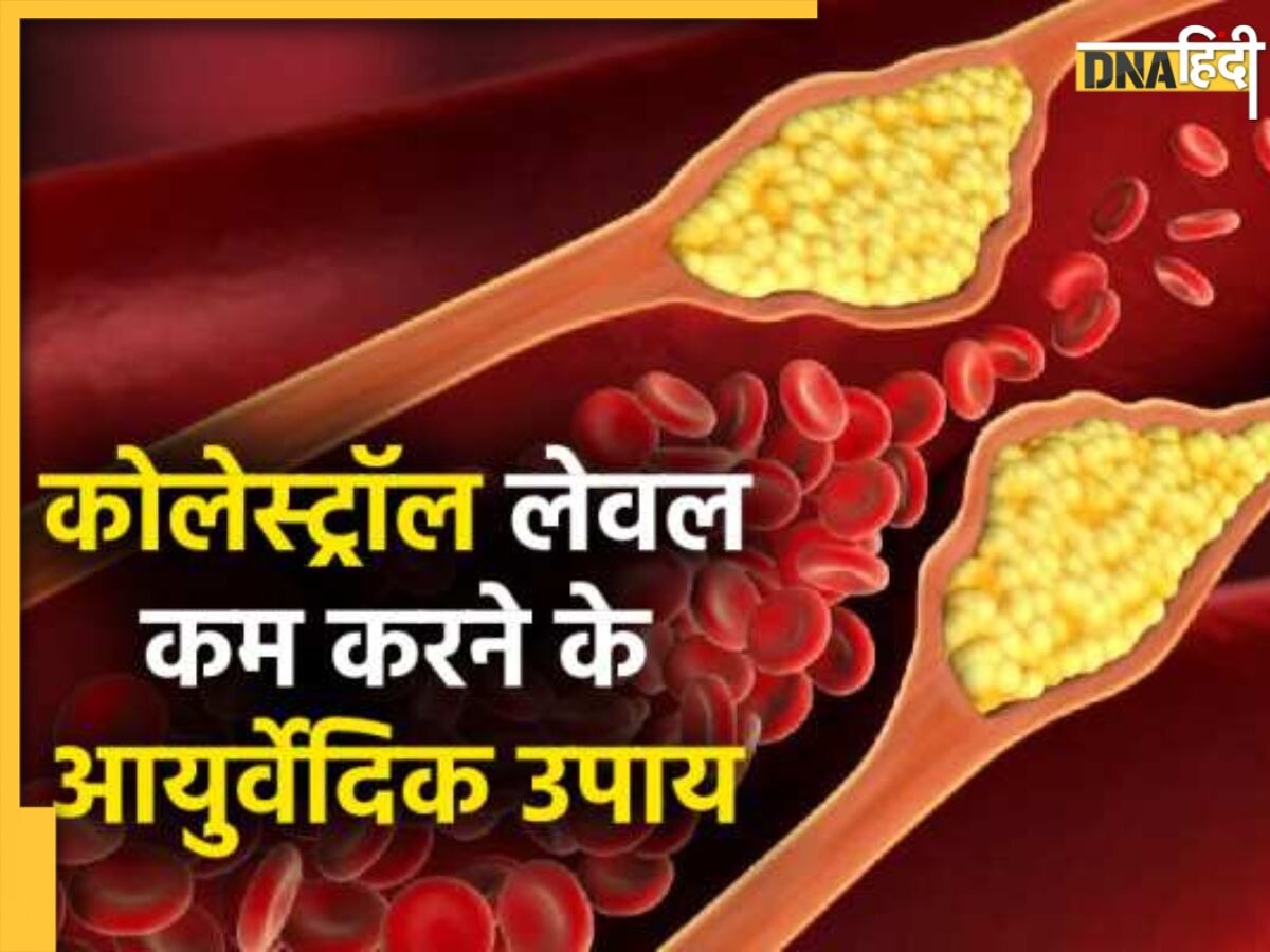 Cholesterol Remedy: धमनियों में जमे गंदे कोलेस्ट्रॉल को ये आयुर्वेद नुस्खे करेंगे बाहर, 5 दिनों में नसों से पिघलने लगेगा फैट