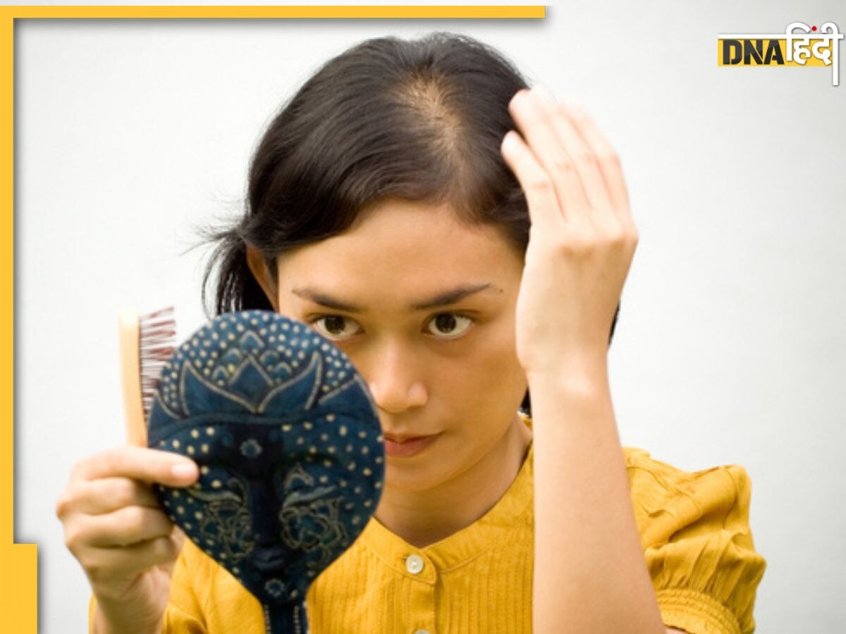 Hair Loss Remedy: बालों का नहीं रूक रहा झड़ना? तो बस आज से शुरू कर दें ये काम, 1 हफ्ते में नजर आएगा रिजल्ट