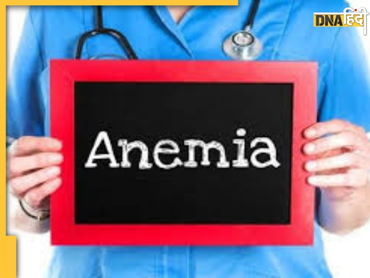 Anemia Remedy: खून की कमी दूर कर देंगी ये आयुर्वेदिक औषधियां, एनिमिया के लक्षण से साथ जान ले खतरे भी