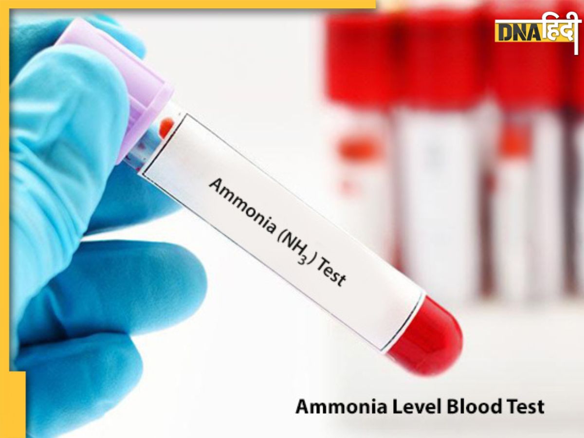 How to lower Ammonia Level ब्लड में अमोनिया का बढ़ता लेवल है डेंजरस