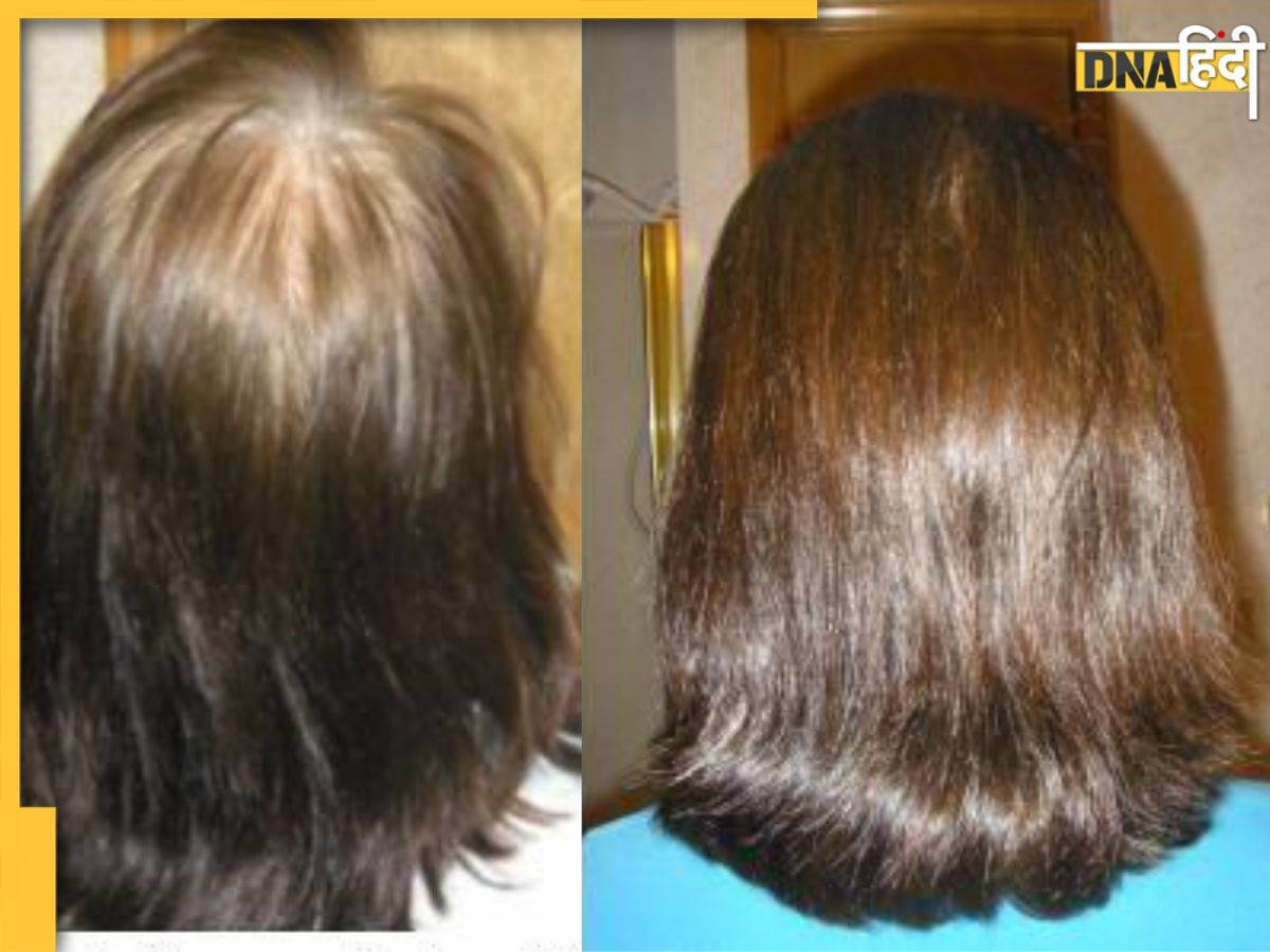 White Hair Remedy: बिना मेहंदी इन 4 चीज से घर पर बनाए Hair Colour Dye, सफेद बाल होंगे Permanent Brownish-Black