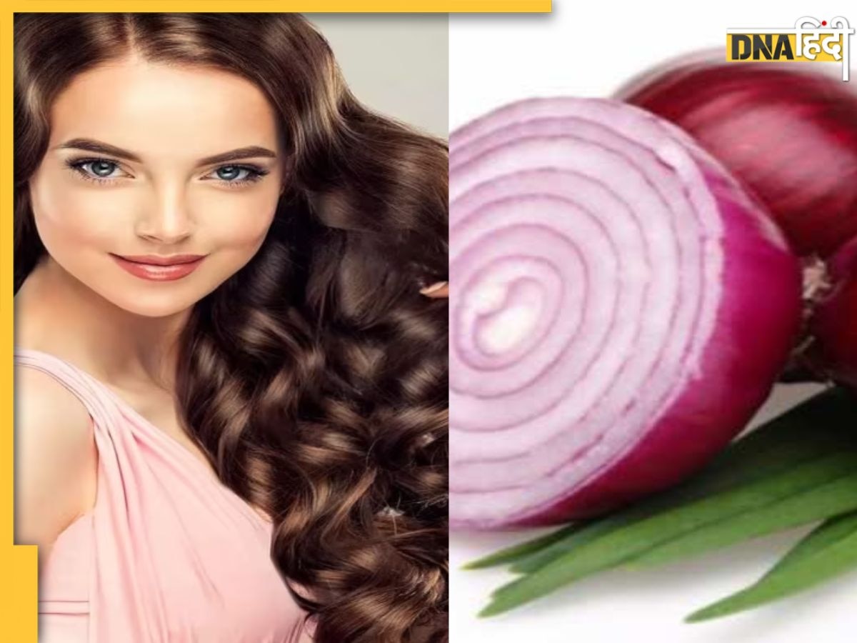 Onion Juice For Hair: बाल झड़ने की समस्या में कितना कारगर है प्याज का रस, जानिए क्या हैं इसके अन्य फायदे  