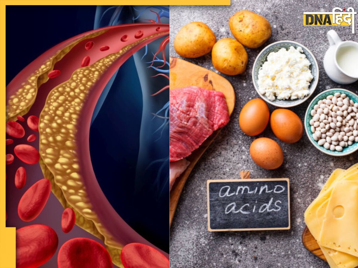 High Ammonia Foods: कोलेस्ट्रॉल और यूरिक एसिड से भी खतरनाक है अमोनिया, इन 10 चीजों के सेवन से खून में घुस जाता है जहर