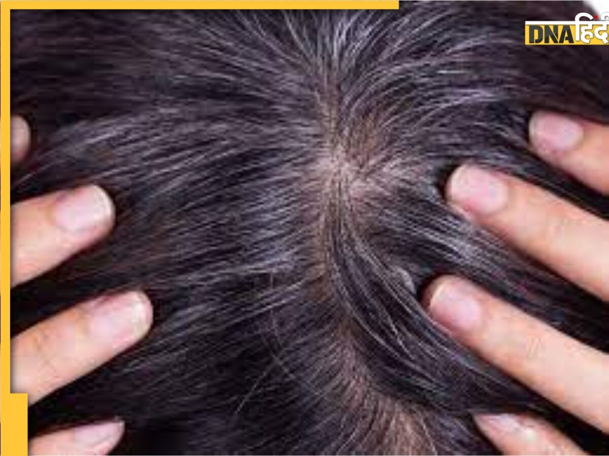 White Hair Remedy: सफेद बाल 1 घंटे में हो जाएंगे Black, बस हिना पाउडर में मिक्स कर लें ये 4 चीजें