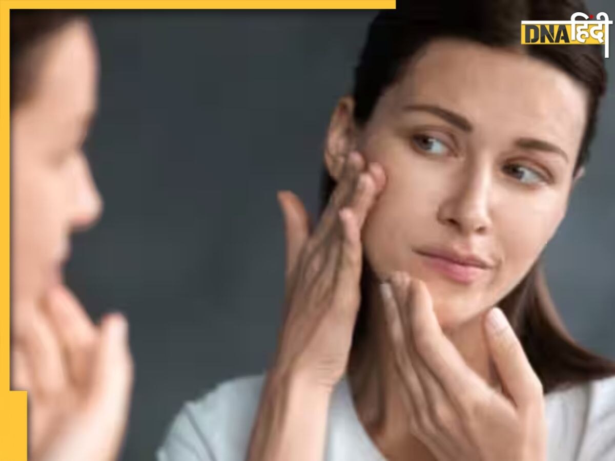 Skin Care Tips: आसान घरेलू उपायों से हटाएं जिद्दी ब्लैक हेड्स, एक इस्तेमाल से ही दिखने लगेगा असर