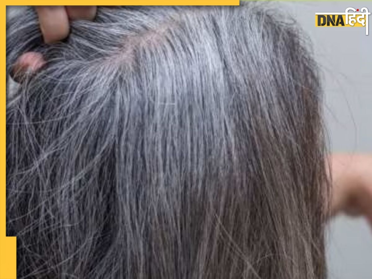 White Hair Tips: रात में सोते समय बालों में लगाएं तेल में मिलाकर ये चीज, White Hair हो जाएंगे Permanent Black