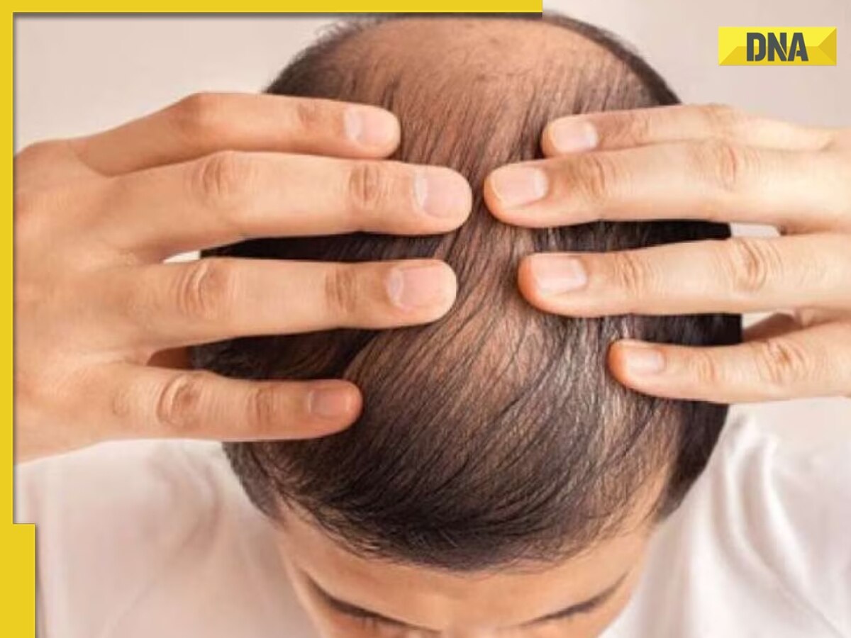 Suffering from hair loss? Here are 5 home remedies that may help