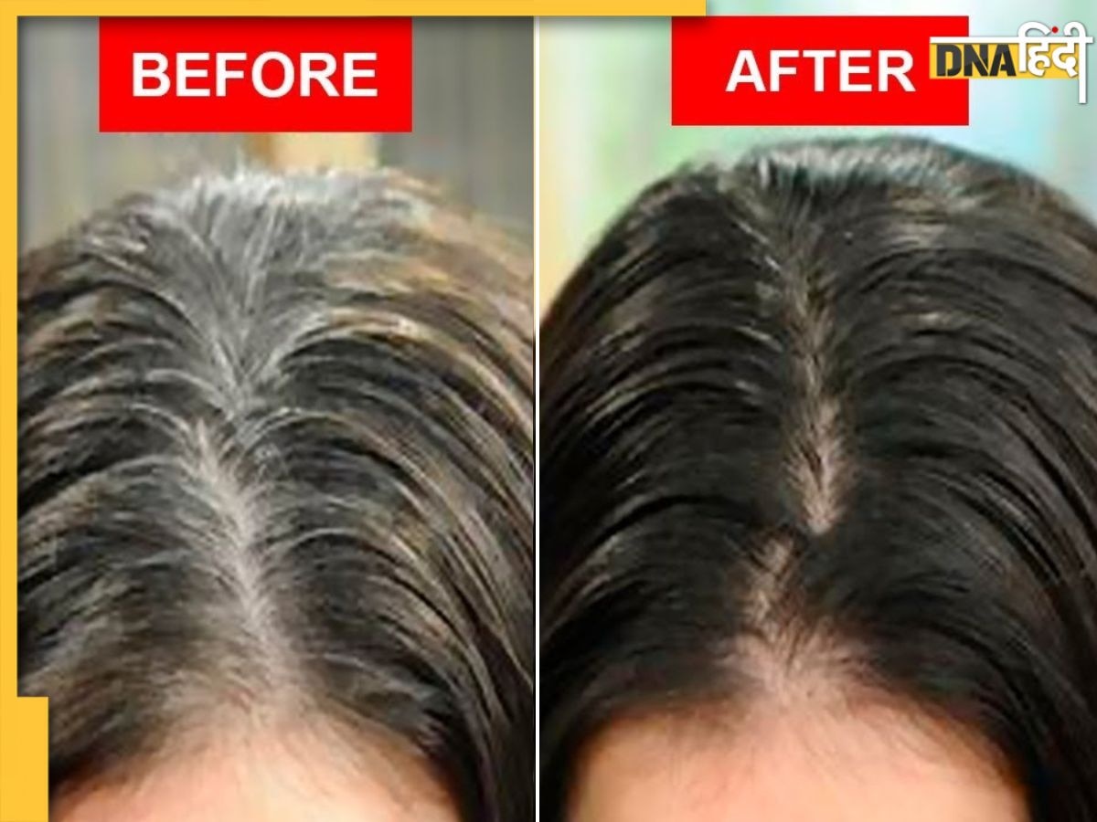 White Hair Remedy: रोस्टेड आंवले-कत्थे से बनाएं Permanent हेयर डाई, सफेद बालों को मिलेगा Natural Black Colour