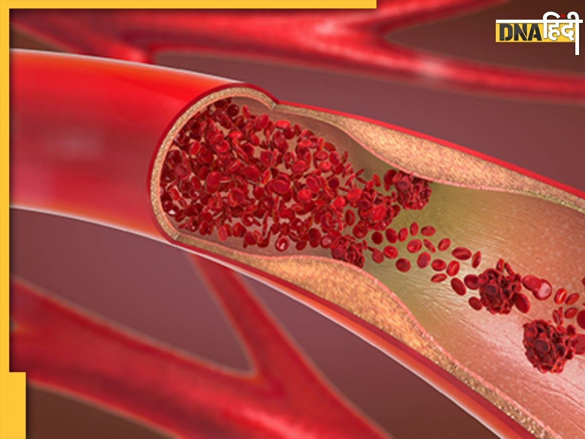 Yoga For Cholesterol: नसों में जमे गंदे कोलेस्ट्रॉल को बाहर निकाल देंगे ये 5 योगासन, जानें इनके फायदे