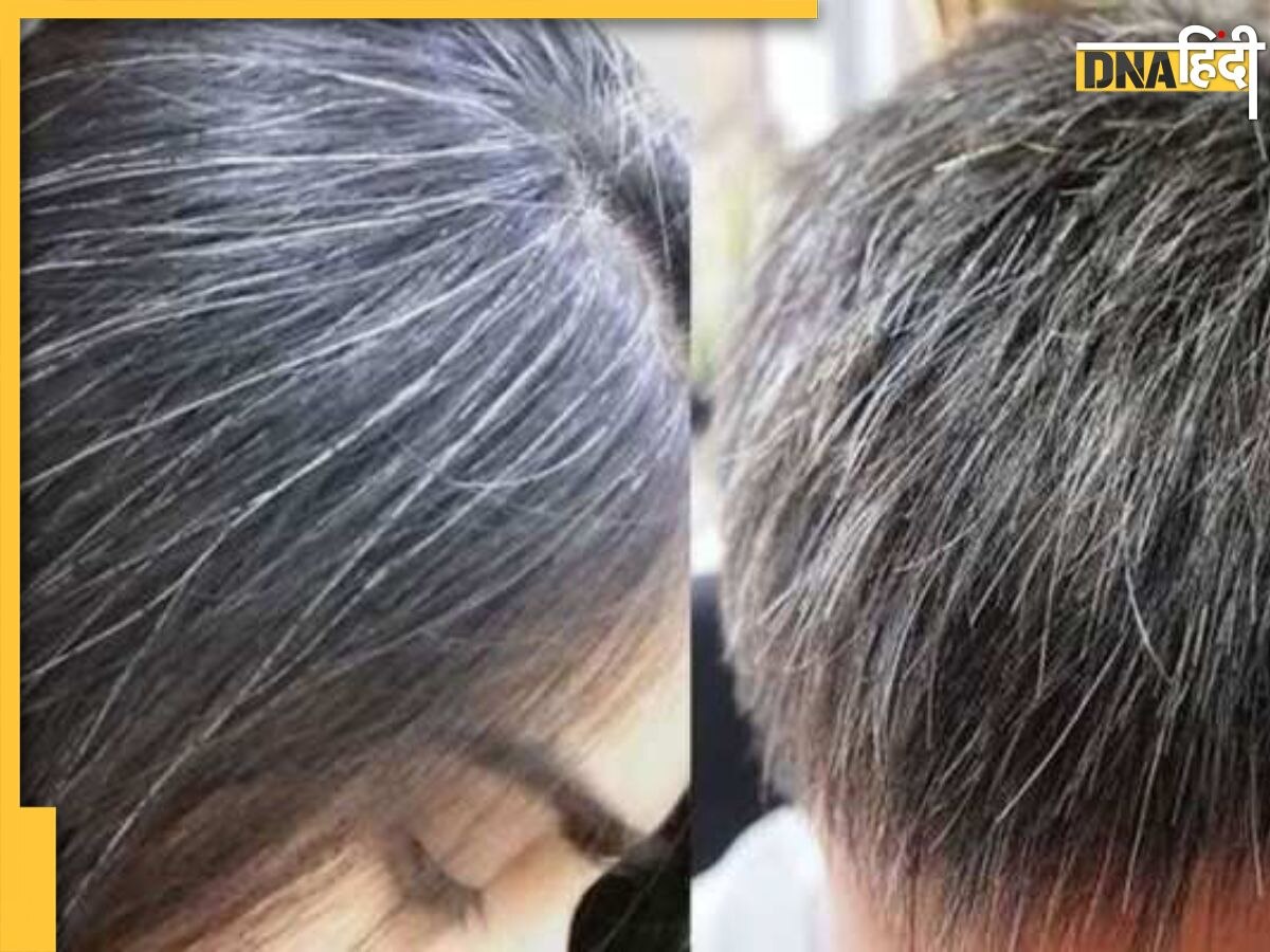 White Hair Remedy: बिना कैमिकल डाई-कलर के सफेद बालों को Permanent Black कर देगी हल्दी, ऐसे तैयार करें हेयर मास्क