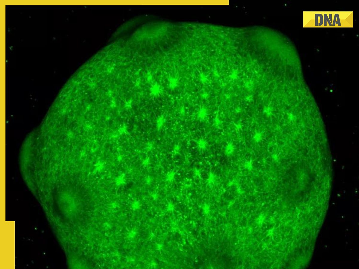 What are 'minibrains' and why scientists are growing them in labs?