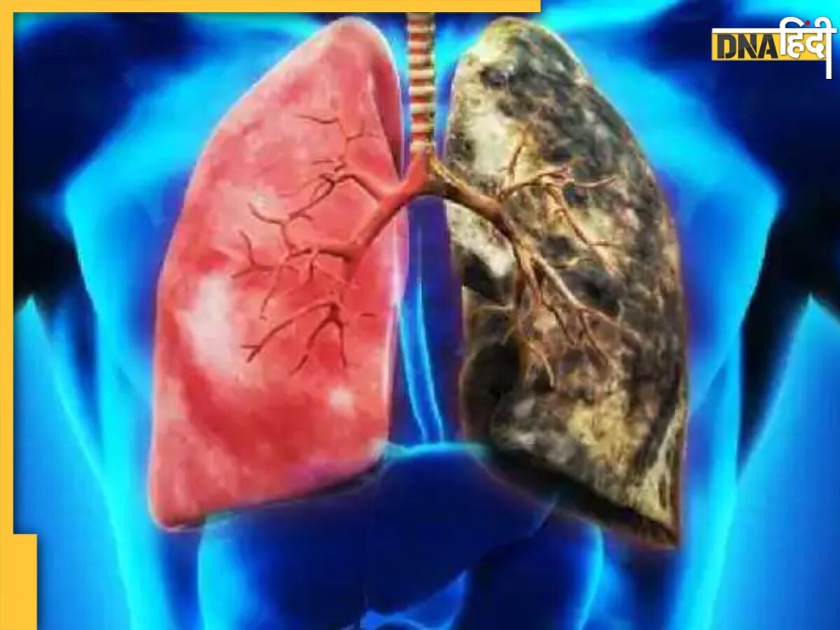 Healthy Lungs Tips: ये आसान टिप्स फेफड़ों की जमा गंदगी को खींचकर निकाल देंगे बाहर, लंग्स को रखेंगे हेल्दी