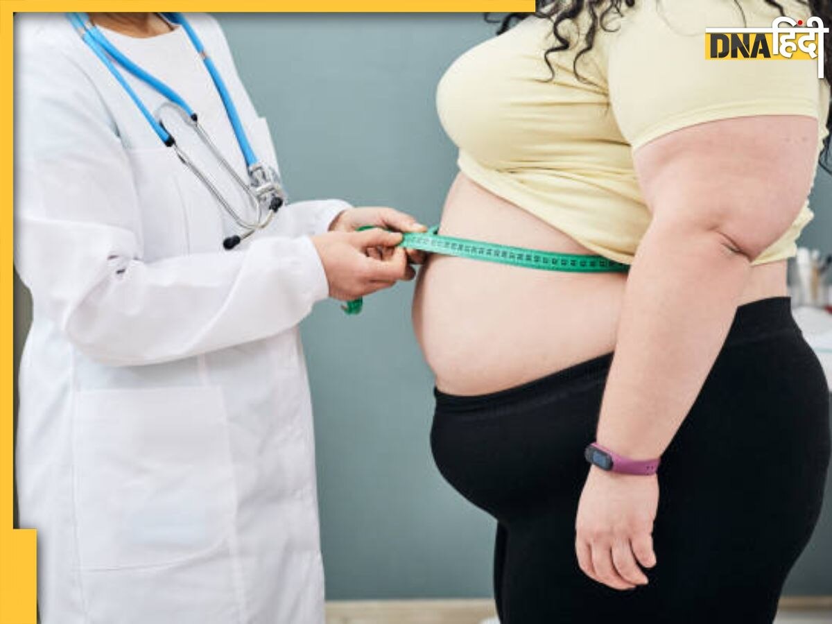 World Obesity Day: मोटापे से बढ़ जाता है डायबिटीज और हार्ट अटैक का खतरा, इस तरह वजन को करें कंट्रोल