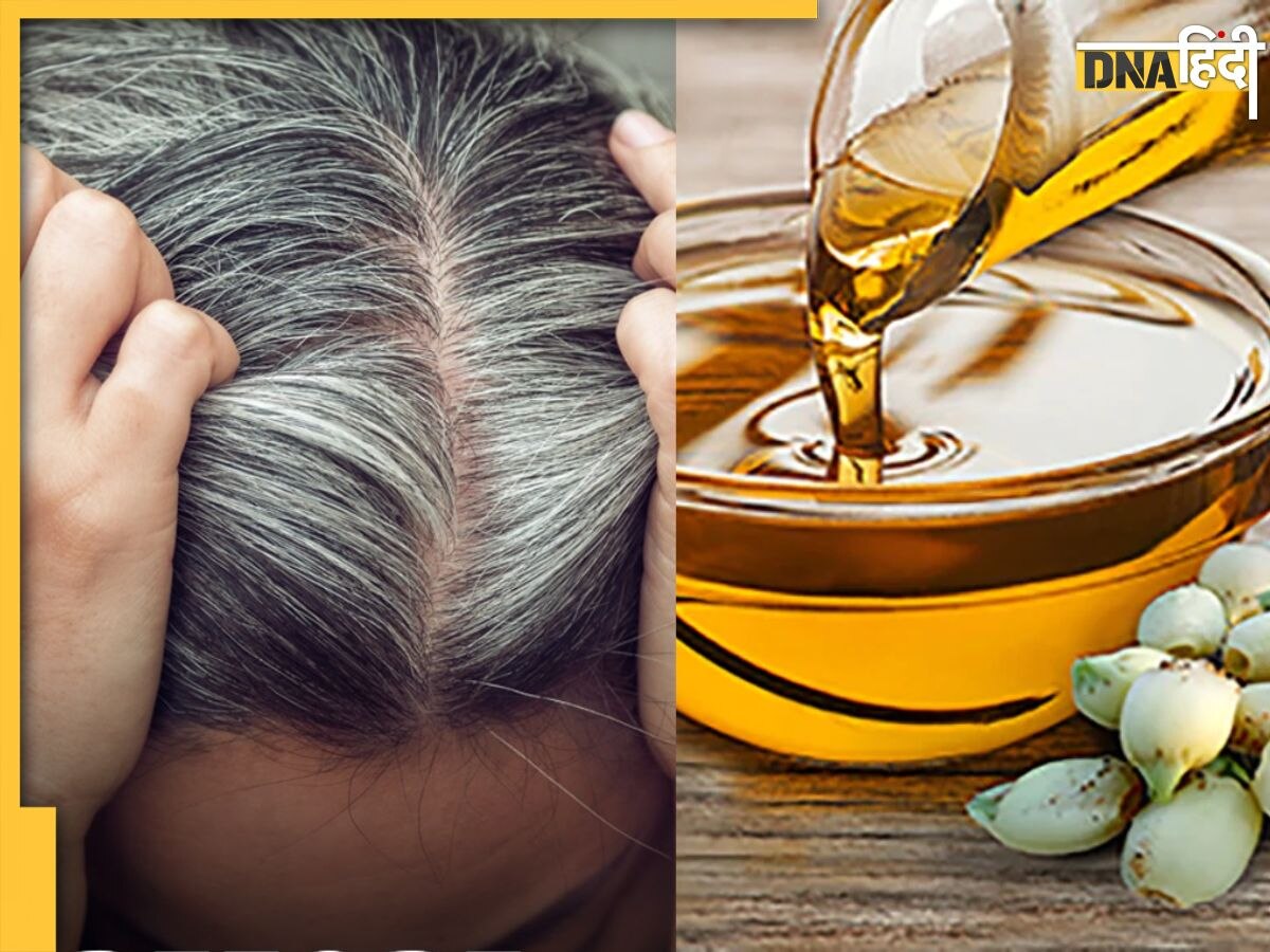 White Hair Remedy: सफेद बालों से हैं परेशान तो इस एक तेल से करें मसाज, Natural Black और शाइनी हो जाएंगे बाल