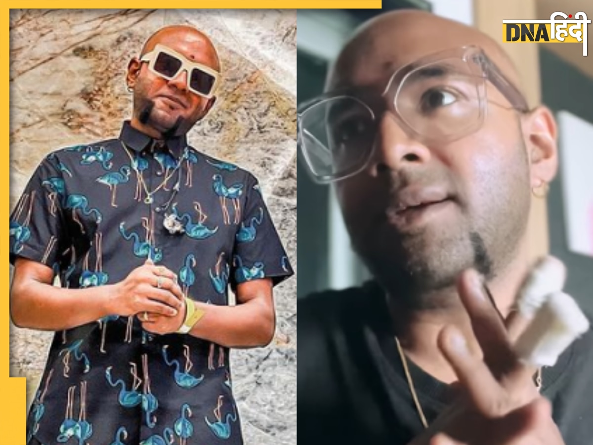 सिंगर Benny Dayal के साथ लाइव कॉन्सर्ट के दौरान हुआ हादसा, सिर पर गिरा ड्रोन, वीडियो जारी कर दिया हेल्थ अपडेट 