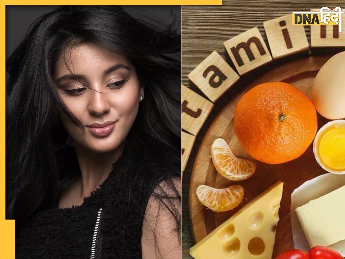 White Hair Remedy:सफेद बालों की जड़ है इस Vitamin की कमी, डाइट में इन चीजों को शामिल करते ही Black और शाइनी हो जाएंगे बाल White Hair Remedy:सफेद बालों की जड़ है इस Vitamin की कमी, डाइट में इन चीजों को शामिल करते ही Black और शाइनी हो जाएंगे बाल