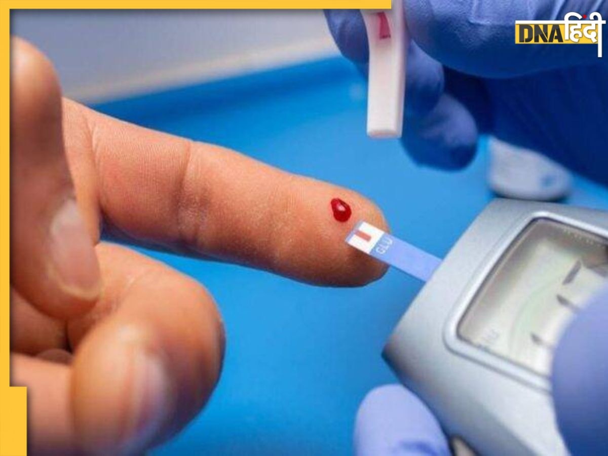 Diabetes Control Tips: सुबह के समय ब्लड शुगर लेवल रहता है हाई? ये डाइट टिप्स और ट्रिक्स डायबिटीज कर देंगे कंट्रोल