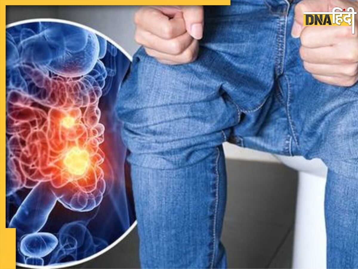 Colorectal Cancer Symptoms: टॉयलेट में दिखते हैं इस कैंसर के लक्षण, पहचानने में देरी होते ही ब्लॉक कर देता है आंतें