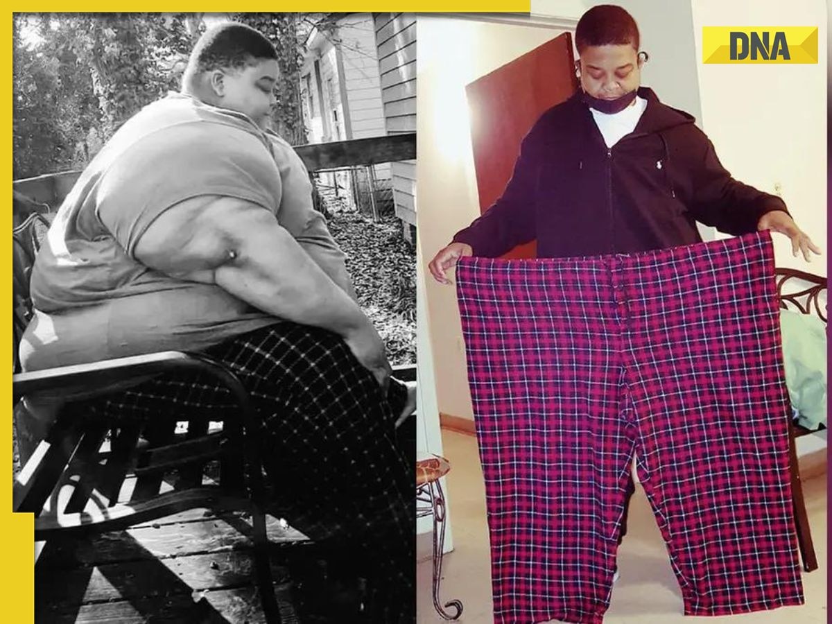 294 kg man sheds 165 kg after doctor said he was 'ticking time bomb', shares stunning before-after pic