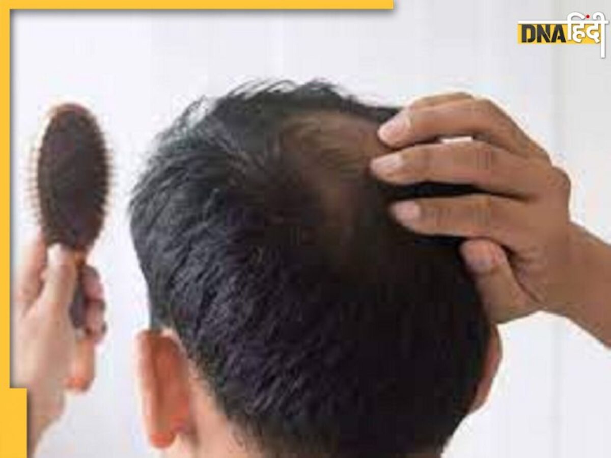 Hair Fall Remedy: झड़ते-रूखे बालों को जड़ से मजबूत कर देंगे ये 4 तेल, मसाज करने से हो जाएंगे घने और लंबे बाल 