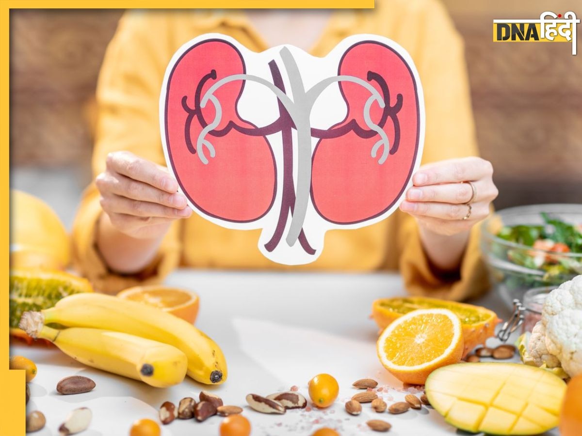 Home Remedies For Kidney : किडनी की सफाई के लिए रामबाण हैं ये 10 फूड्स, आज से ही शुरू कर दें सेवन