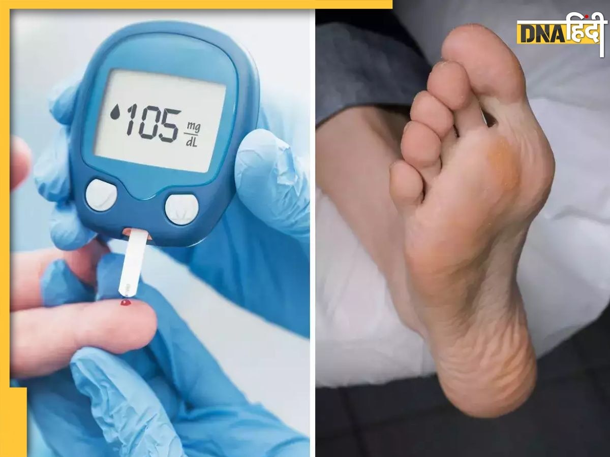 Diabetes Symptoms: पैरों में दर्द और झुनझुनी हो सकते हैं हाई ब्लड शुगर के संकेत, ये 6 लक्षण दिखते ही हो जाए सतर्क