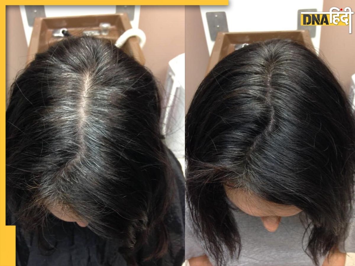 Natural Hair dye: सफेद बाल के लिए ऐसे तैयार करें नेचुरल हेयर कलर डाई, इमरजेंसी में 5 मिनट में Black हो जाएं�गे हेयर