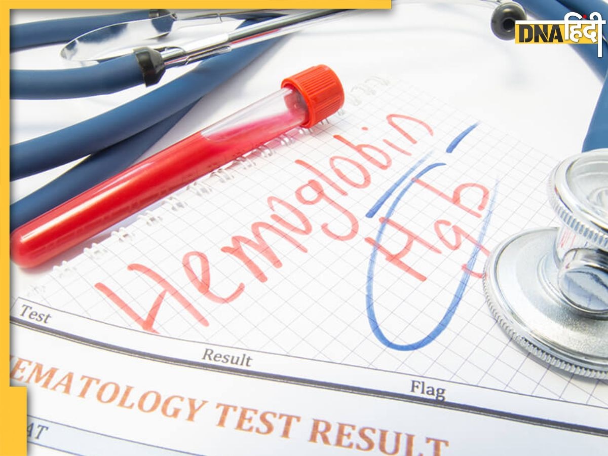 Hemoglobin Effects : महिला और पुरुषों में कितना होना चाहिए हीमोग्लोबिन, जानें कम होने की वजह और उसे बढ़ने वाली बीमारियां