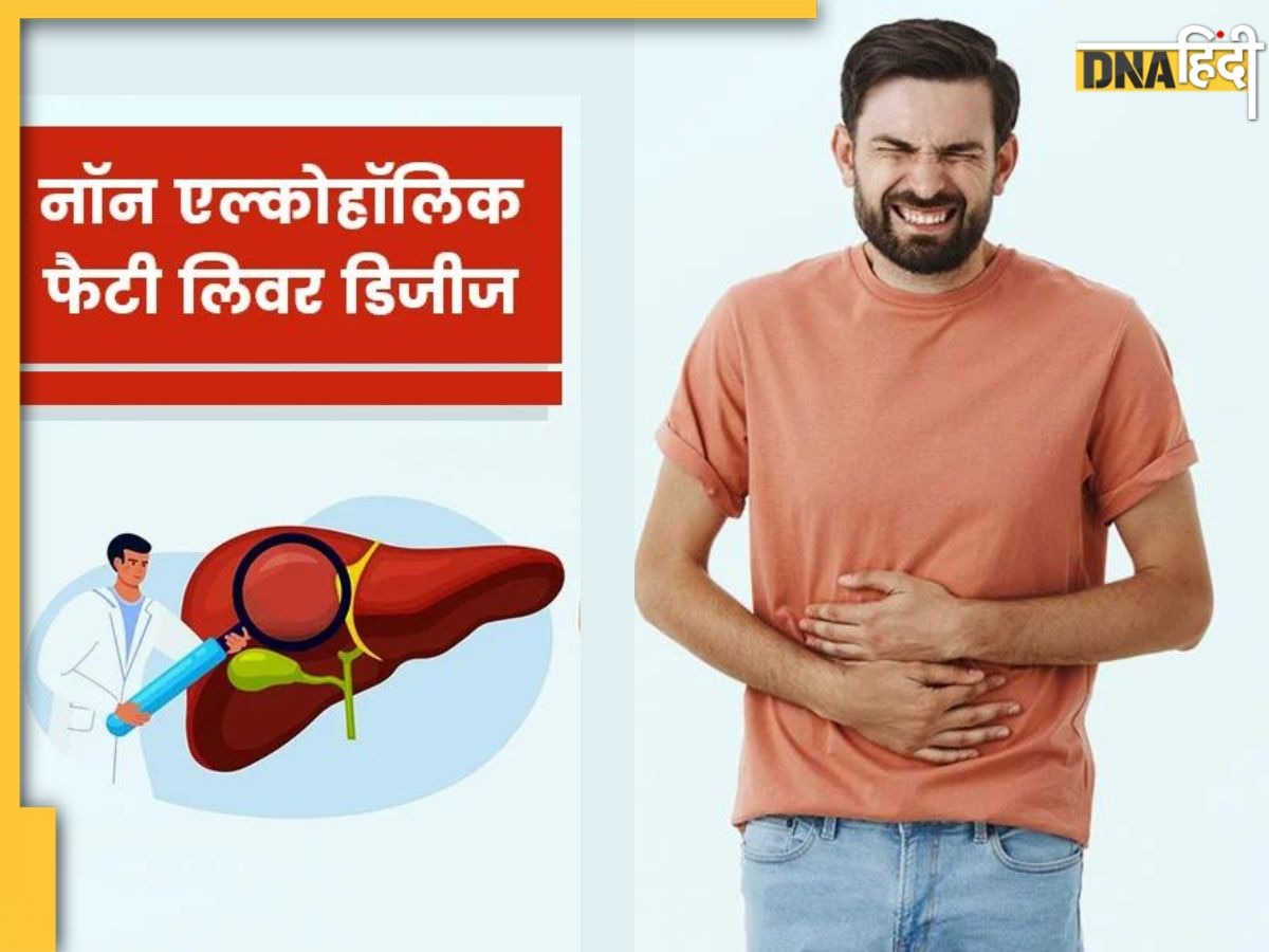 Fatty Liver Symptoms: चेहरे और स्किन पर नजर आने वाली ये दिक्कतें फैटी लिवर का भी देती हैं संकेत