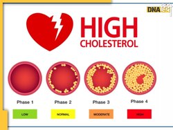 Bad Cholesterol: नसों में जमा गंदा कोलेस्ट्रॉल कम करने का ये है बेस्ट तरीका, खून में जमी वसा तेजी से पि�घलने लगेगी