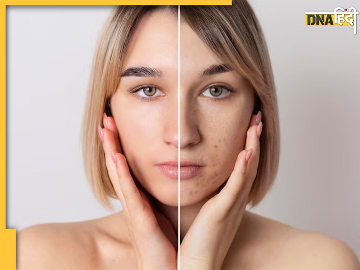 Skin Pores में जमा गंदगी हटाने के साथ चेहरे को ग्लोइंग बनाती हैं ये 3 नेचुरल चीजें, लगाने से पहले जान लें सही तरीका