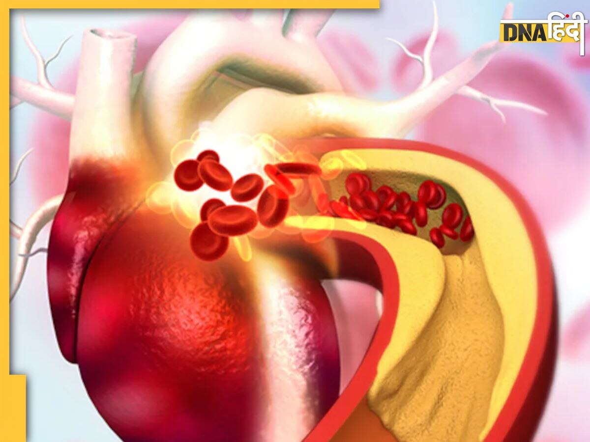 Foods For Control Cholesterol: गर्मियों में कोलेस्ट्राॅल को कम करते हैं ये 4 फूड्स, डाइट में शामिल करने पर हार्ट भी रहेगा हेल्दी