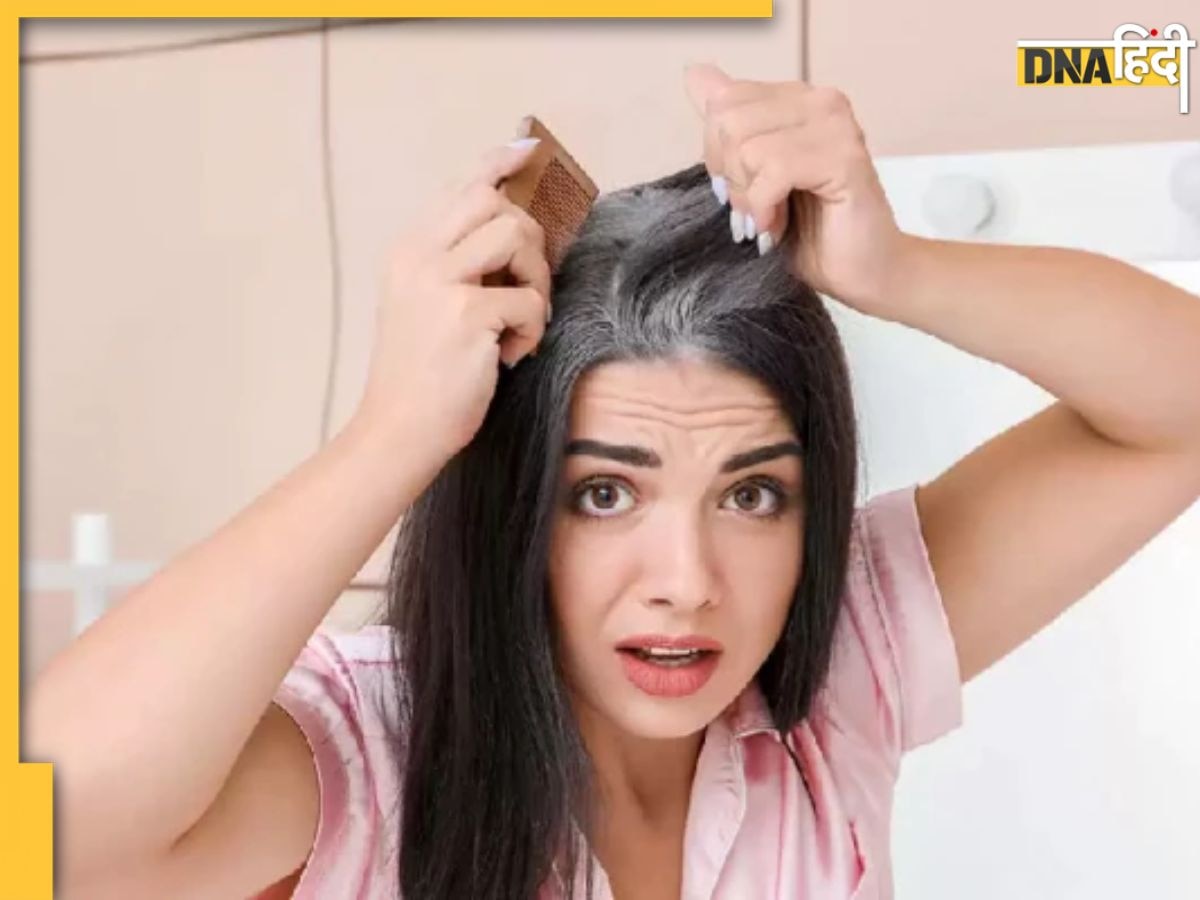 White Hair Remedy: रात को सोने से पहले लगा लें ये 3 चीजें, अगली सुबह काले नजर आएंगे बाल, वाइट हेयर से मिलेगा छुटकारा