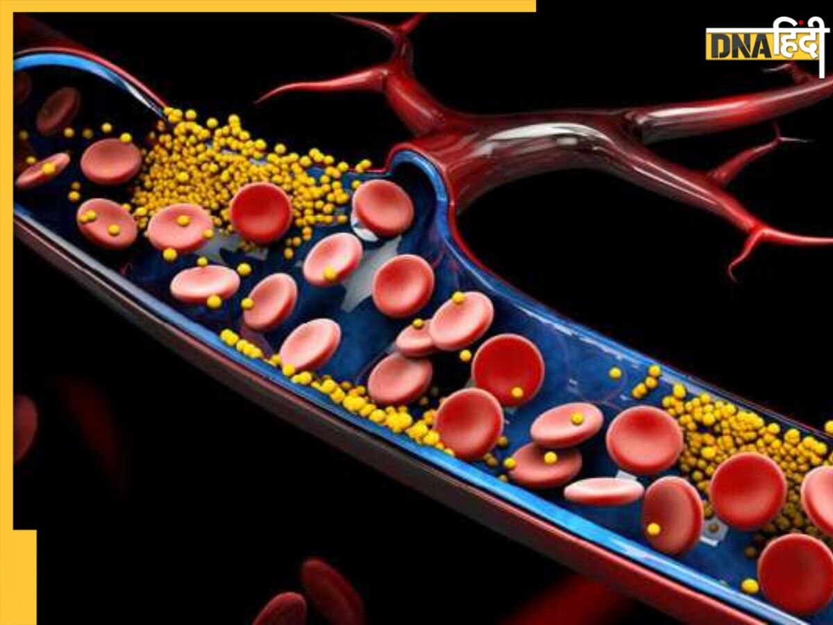 High Cholesterol: कम उम्र में हाई कोलेस्ट्रॉल से बढ़ जाती है White Hair की समस्या, समय से पहले बूढ़ा होने ल�गता है शरीर 