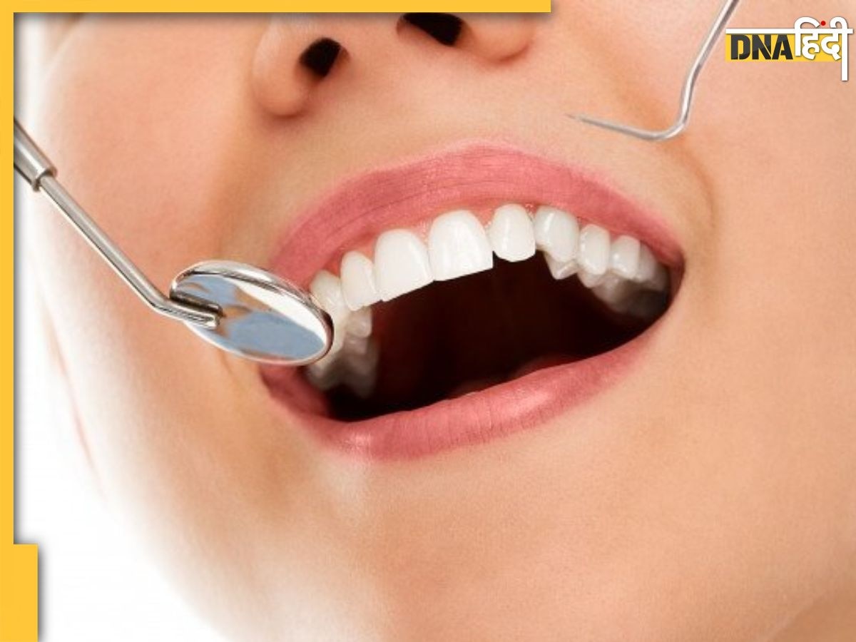 Teeth Cleaning Remedy: सेहत बिगाड़ सकती है दांतों की सड़न, इन Tricks को अपनाकर चमकदार दांतों के साथ खुद भी रहेंगे Fit