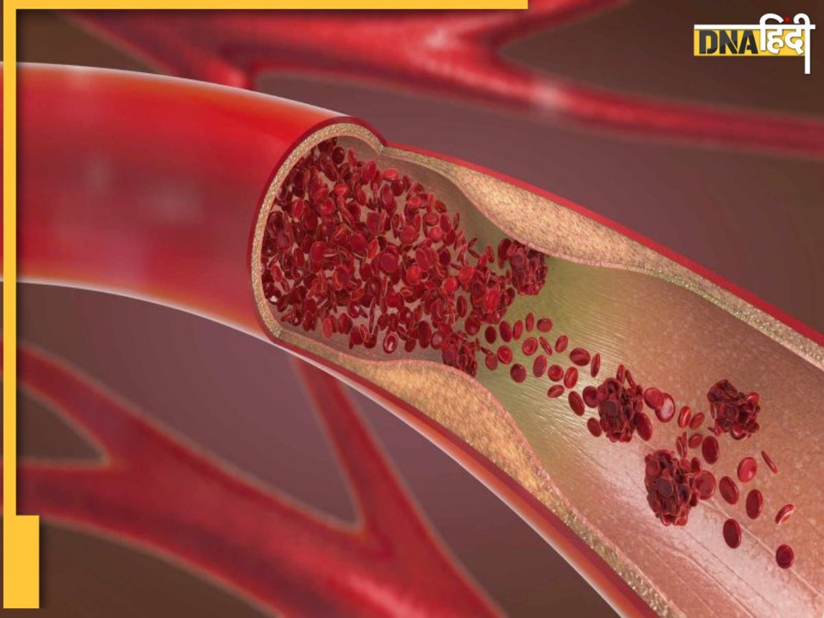 Strong Nerves Remedy: नसों में खून का दौरा बढ़ा देंगी ये चीजें, दूर होगी वेन्स की वीकनेस और सूजन 