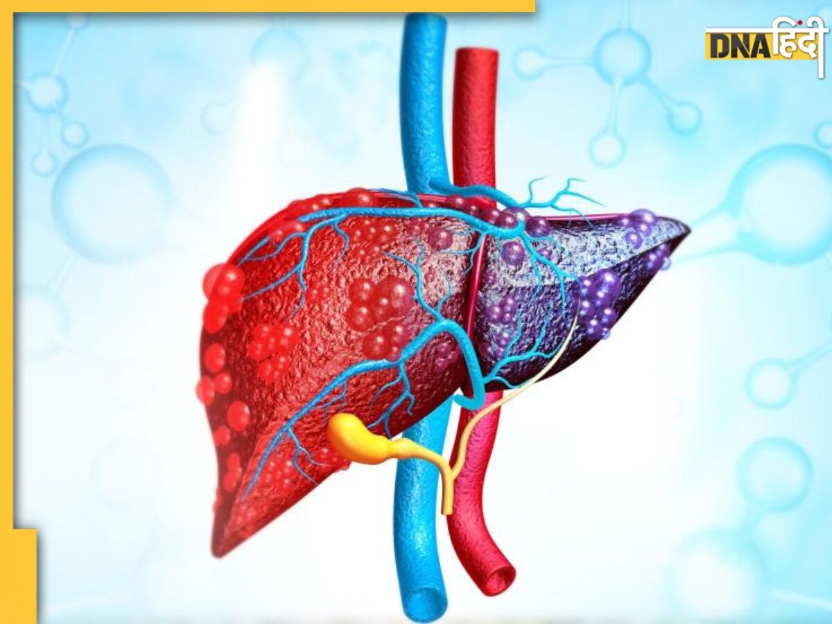 Liver Damage Sign: रोज रात 1 से 4 बजे के बीच टूट रही नींद तो समझ लें लिवर डैमेज का है ये संकेत