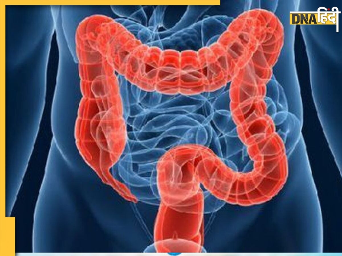 World Irritable Bowel Syndrome Day: हर समय पेट फूला या भारीपन महसूस होना आंतों के बीमार होने का है पहला संकेत