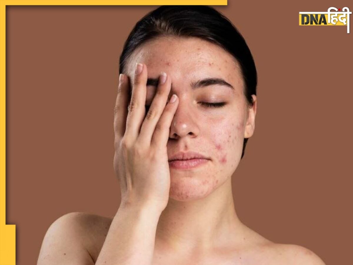 Skin Care Routine में कहीं आप भी तो नहीं करती हैं ये गलतियां? तुरंत कर लें सुधार वरना स्किन हो जाएगी डैमेज