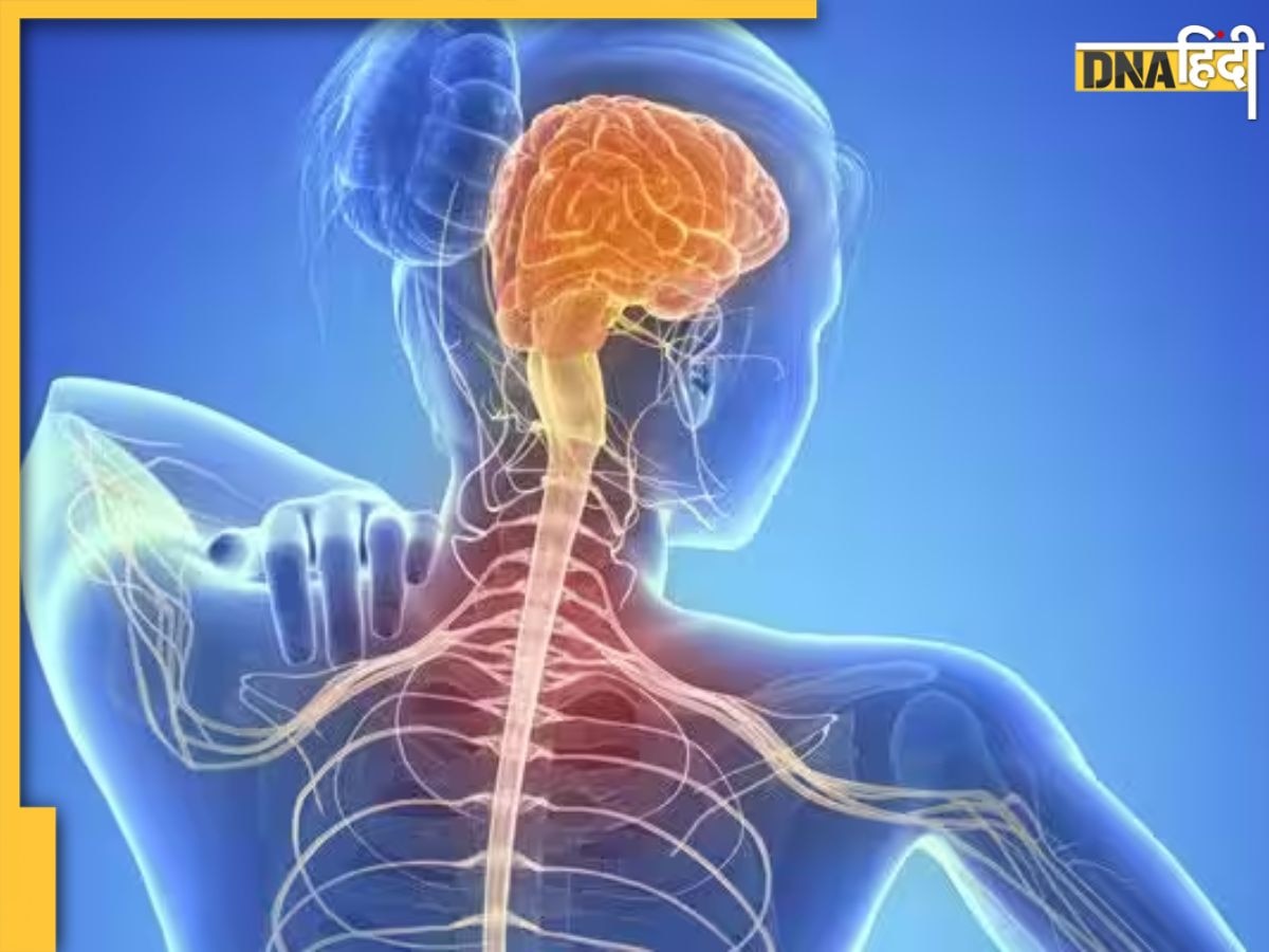 Multiple Sclerosis डिसऑर्डर क्या है जिससे मनीष सिसोदिया की पत्नी पीड़ित है? जान लें इसके लक्षण-कारण और इलाज