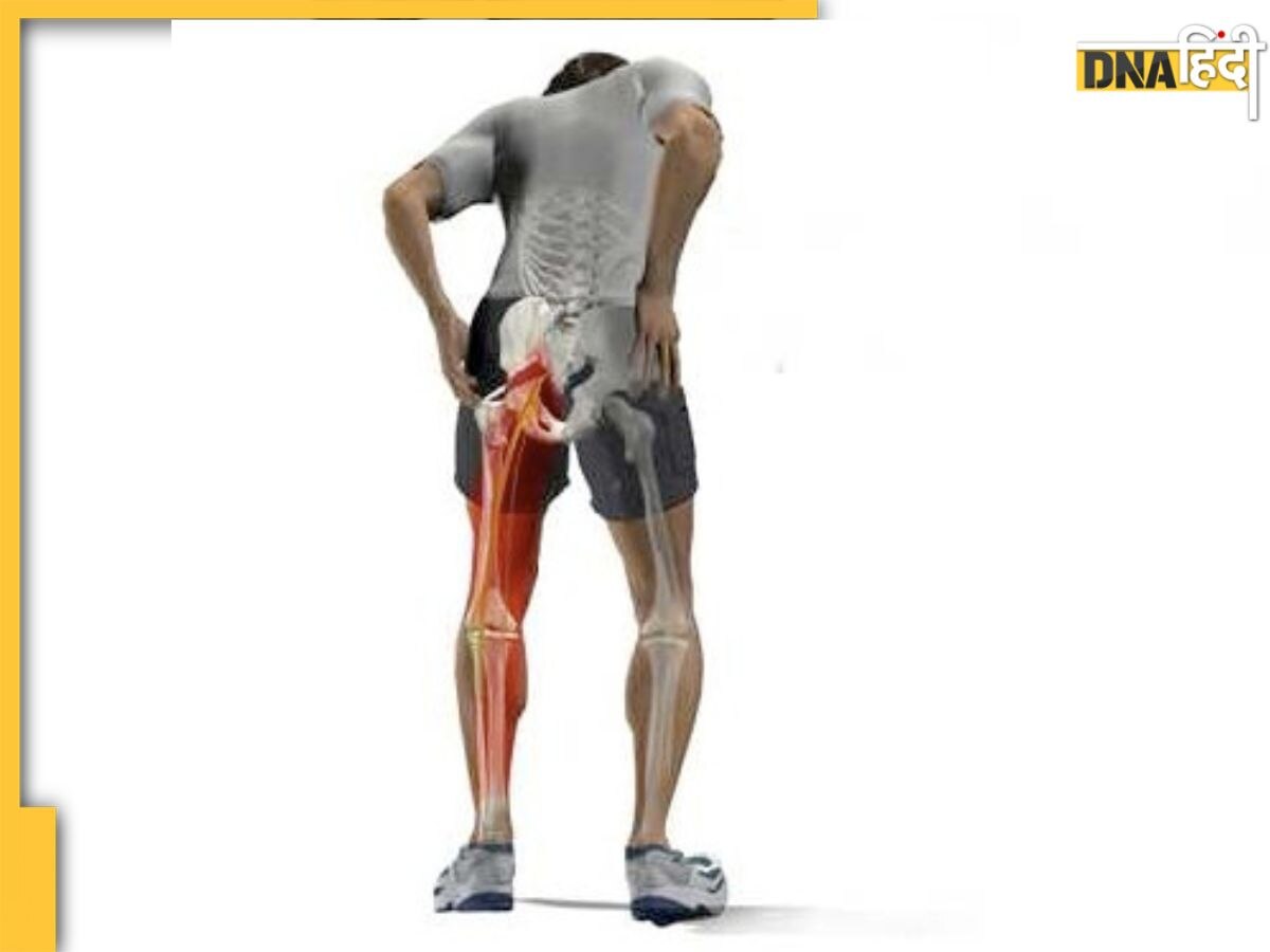 Back-Hip Pain: कमर या साइटिका के दर्द हैं परेशान? आलिया भट्ट के ट्रेनर ने बत��ाया कैसे इस योग से चुटकियों दूर होगा पेन